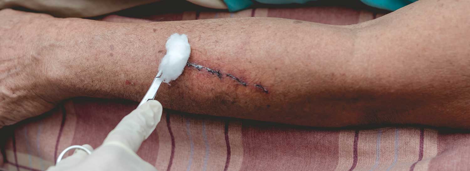 Medical treatment on an injured arm from a dog attack