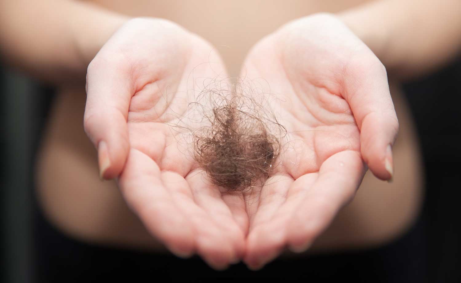 Woman holding lost hair in hands